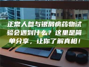 临沂正常人参与银屑病药物试验会遇到什么？这里是简单分享，让你了解真相！